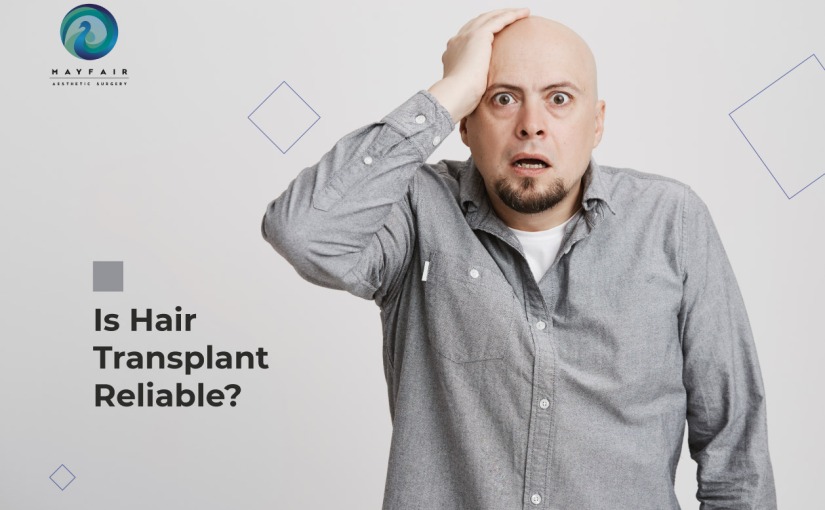 Is hair transplant Reliable?